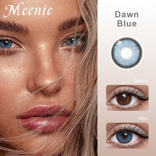 Contact lens